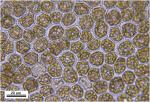 Radula obconica Sullivant
