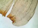 Rhytidiadelphus triquetrus (Hedw.) Warnst.