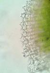 Riccia sorocarpa Bischoff