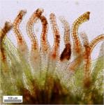 Rosulabryum laevifilum (Syed) Ochyra