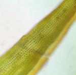 Schistidium liliputanum (Müll. Hal.) Deguchi
