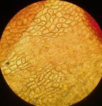 Schistidium viride H. H. Blom & C. Darigo