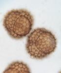 Sphaerocarpos michelii Bellardi