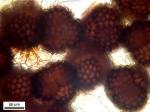 Sphaerocarpos texanus Austin