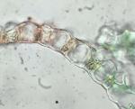 Sphagnum palustre Linnaeus