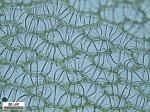 Sphagnum palustre Linnaeus