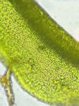 Zygodon viridissimus (Dickson) Brid. var. rupestris Lindb.